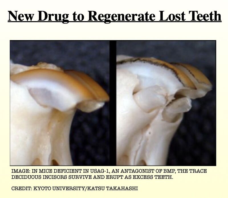 Groundbreaking Research Unveils Potential for Natural Tooth Regrowth with Monoclonal&nbsp;Antibodies